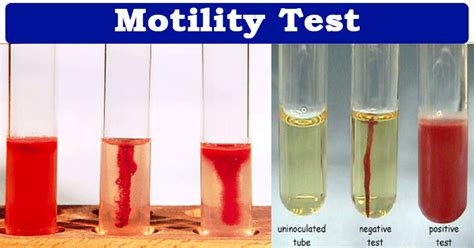 e coli motility test results.